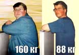 я похудел на 72   кг Истории похудения