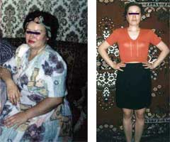 фото до и после похудения 16